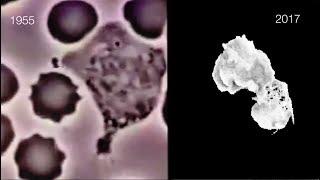 See White Blood Cells Move in 3-D Imaging