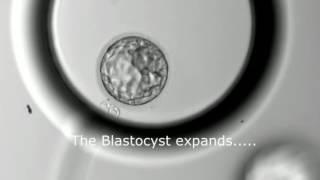 Blastocyst Development - Day 3 to Day 5 MUST SEE