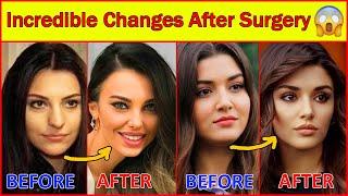 20 Turkish Actresses Before and After Surgery  Plastic Surgery Turkish Drama