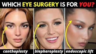 Blepharoplasties 101 Which eye surgery will make YOU look younger?