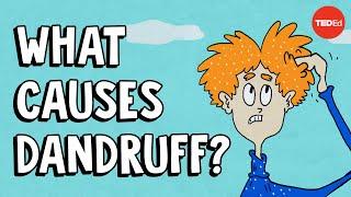 What causes dandruff and how do you get rid of it? - Thomas L. Dawson