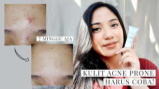 SPOT TREATMENT BRAND LOKAL TERBAIK  Pratista Derma Pure Gel Treatment