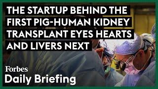 The Startup Behind The First Pig-Human Kidney Transplant Eyes Hearts And Livers Next