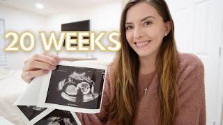 20 WEEK PREGNANCY UPDATE + ANATOMY SCAN RESULTS   KAYLA BUELL