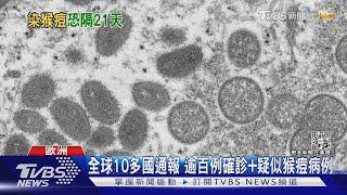 英國出現猴痘「人傳人」 莊人祥密切關注｜TVBS新聞