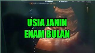 USIA JANIN 6 BULAN - Jenis Kelamin Sudah Terlihat