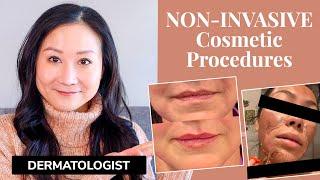 Dermatologist Explains NON INVASIVE Cosmetic Procedures  Botox Fillers Peels Lasers + MORE