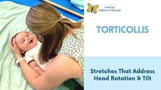 Torticollis 2 Stretches To Try At Home