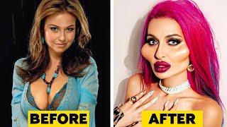 Celebrities Before and After Plastic Surgery