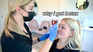 I GOT BOTOX TREATMENT FOR THE FIRST TIME *being transparent migraines & why i decided to do it*