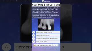 NEET MDS  INI-CET MDS  PSC  BDS - Most Important Questions  #neetmds2025 #mdsprep