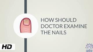 HOW AND WHY SHOULD DOCTOR EXAMINE THE NAILS?