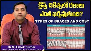 క్లిప్స్ చికిత్స రకాలు Types of Braces in Telugu  Dental Treatment Cost  Eledent Dental Hospitals