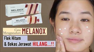 MELANOX  Cream Penghilang Flek Hitam dan Bekas Jerawat Beli di Apotek