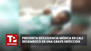 Presunta negligencia médica en Cali desembocó en una grave infección 21.07.2024 TPNoticias