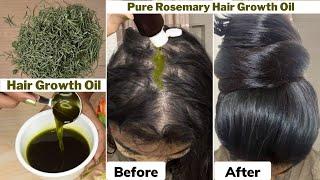 I usedthis Rosemary Hair Growth Oil on Thinning Hair & Bald Scalp-Got 10 times Thick Hair Growth