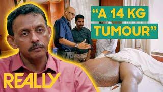 Man Has Had A Huge Tumor On His Thigh For 30 Years  Body Bizarre