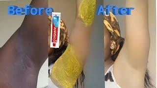 How To Lighten Dark Underarm Naturally and Fast