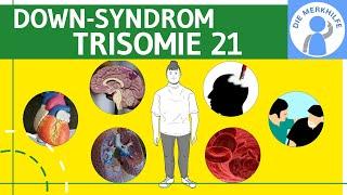 Down Syndrom  Trisomie 21 - Definition Merkmale Ursachen & Formen & Unterscheidungen - Genetik