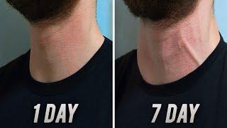 Big Neck in 7 DAYS   Home Exercise 