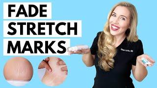 Fade Stretch Marks  Ingredients that WORK and the Science to Back it up