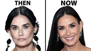 Demi Moores NEW FACE  Plastic Surgery Analysis