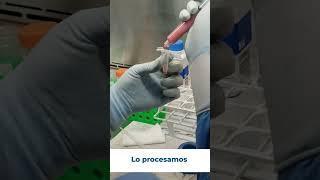 Autismo  Parálisis Cerebral  Terapia Células Madre  Proceso