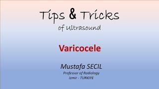 Tips & Tricks of US - Varicocele #ultrasound #testicles #imaging