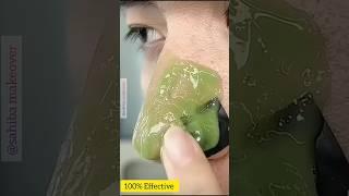 Permanent Blackheads Remove PackWhiteheads Blackheads Remove Tips #beatytips #viralvideo#yttshorts