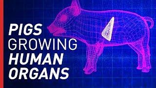 Can Growing Organs in Pigs Solve the Organ Shortage?  Freethink On the Fringe