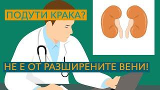 Имате подути крака? Може би не е от разширените вени. Вижте какво е мембранозен гломерулонефрит.