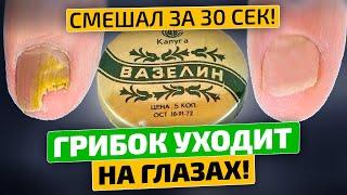 Грибок исчез Кто придумал мешать вазелин с ...? За 2 раза помогло