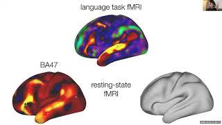 Ultrasonic modulation of brain networks with Dr. Lennart Verhagen