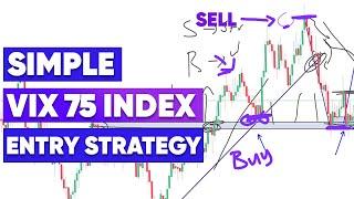 Vix 75 Entry Strategy