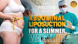 Abdominal Liposuction for a Slimmer Waistline Watch Full Procedure Inside  Liposuction Explained