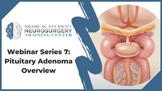 Pituitary Adenoma - Overview