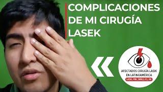 Cirugía de ojos LASEK - Aberraciones de Alto Orden