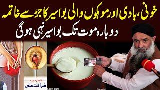 bawaseer ka elaj - Piles Treatment at Home by Dr Sharafat Ali