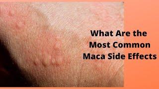 What Are the Most Common Maca Side Effects