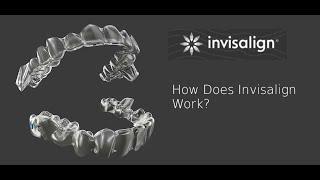 Invisalign clear aligners - how it works?  www.bangkokbraces.com