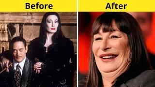 10 Celebrity Plastic Surgery Disasters You Must See