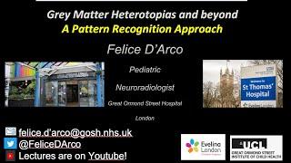 Grey Matter Heterotopia Pattern recognition approach 