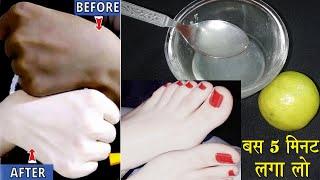 Mix this thing in lemon and apply it for 5 minutes your hands and feet will become milky white and beautiful. Skin Whitening