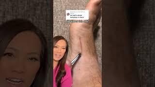 Dr Pimple Popper Reacts to Inflamed Ingrown that Looks SATISFYING to Pull Out