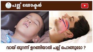 വായ് തുറന്ന് ഉറങ്ങിയാൽ പല്ല് പൊങ്ങുമോ ?Can Sleeping with Your Mouth Open Cause Teeth to Fall Out?