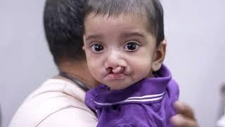 Boy Baby cleft lip surgery  Consultation video