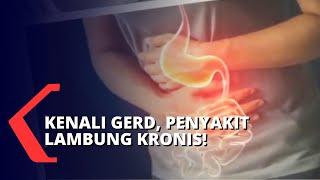 Penyakit Asam Lambung atau Gerd Meningkat di Indonesia Apakah Kamu Salah Satunya?