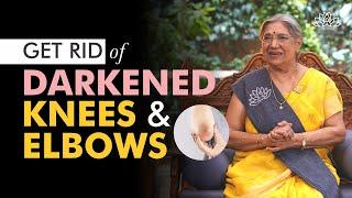 How To Lighten Your Knees Elbows and Armpits with this 5 Natural Home Remedies  Natural Skin Tips