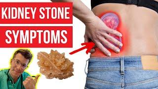 What symptoms do KIDNEY STONES cause? Doctor explains...PLUS how kidney stones are diagnosed & more