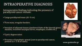 PARATHYROID CANCER